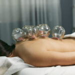 Old Bridge Physical Therapy Cupping Therapy