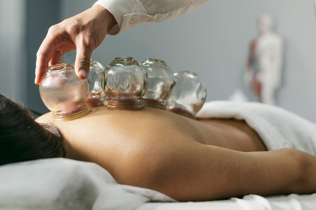 Old Bridge Physical Therapy Cupping Therapy