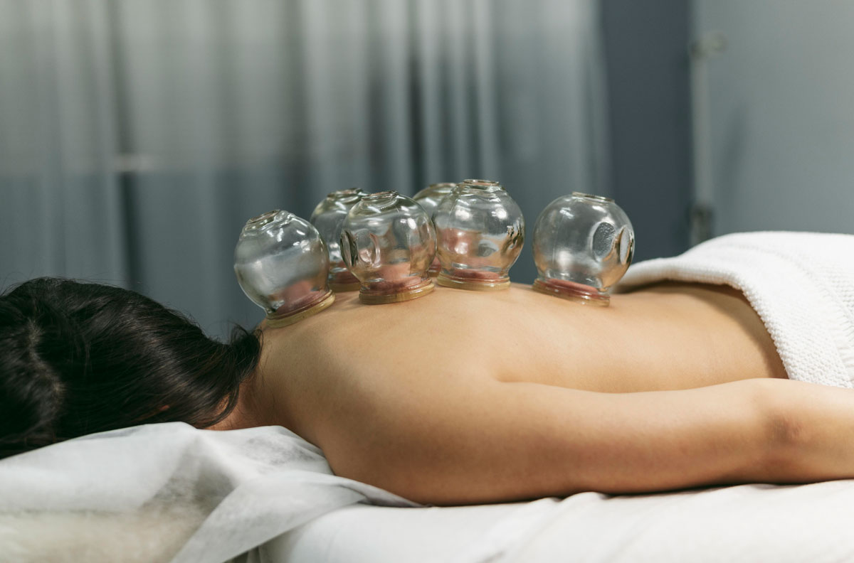 Old Bridge Physical Therapy Cupping Therapy